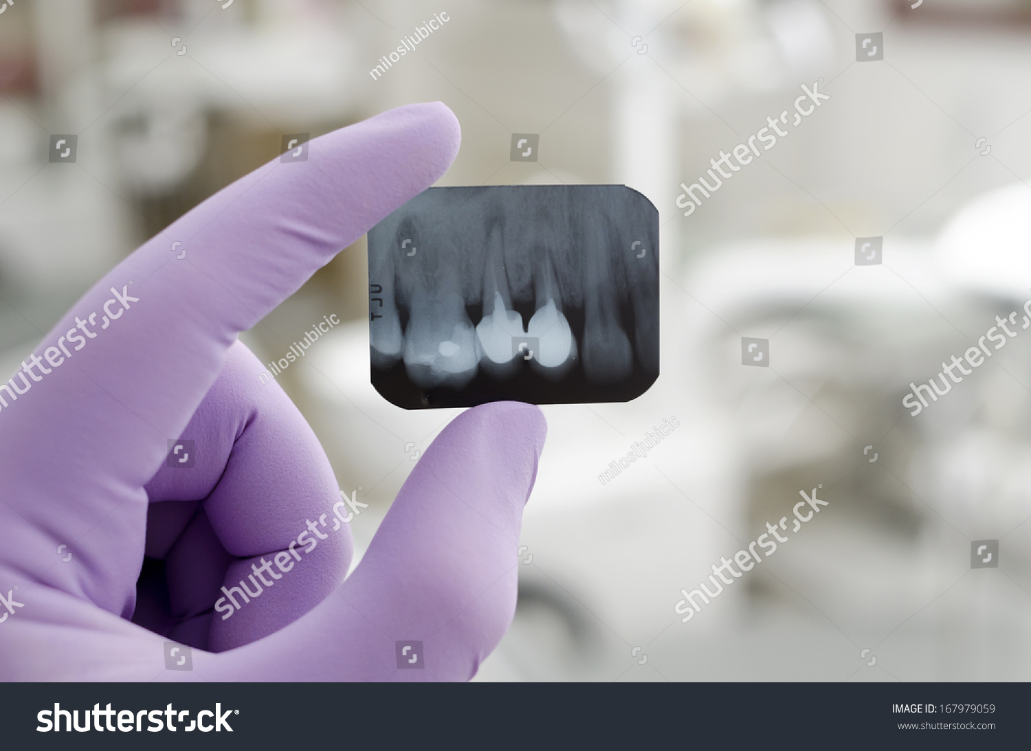 Doctor Holding Looking Dental Xray Stock Photo 167979059 