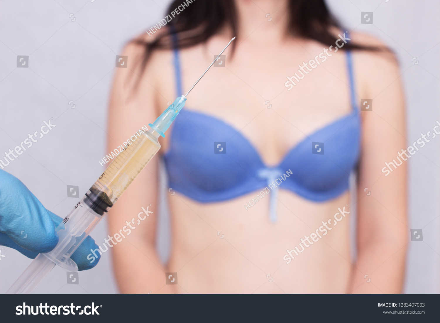 Doctor Holds Syringe Conducts Injection Lipofilling ภาพสต็อก แก้ไขตอนนี้ 1283407003