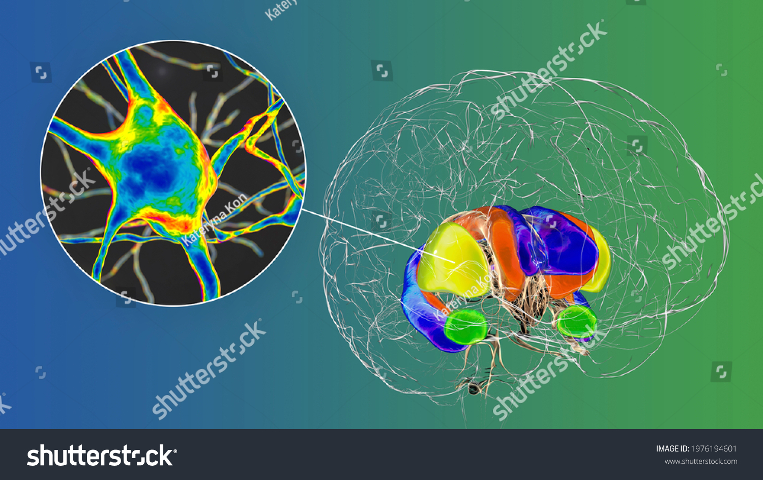 Dorsal Striatum Highlighted Brain Neurons 3d Stock Illustration 1976194601 Shutterstock 7943