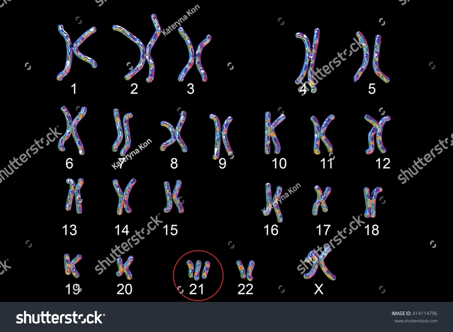 Downsyndrome Karyotype Female Labeled Isolated On ภาพประกอบสต็อก 414114796 Shutterstock 1924