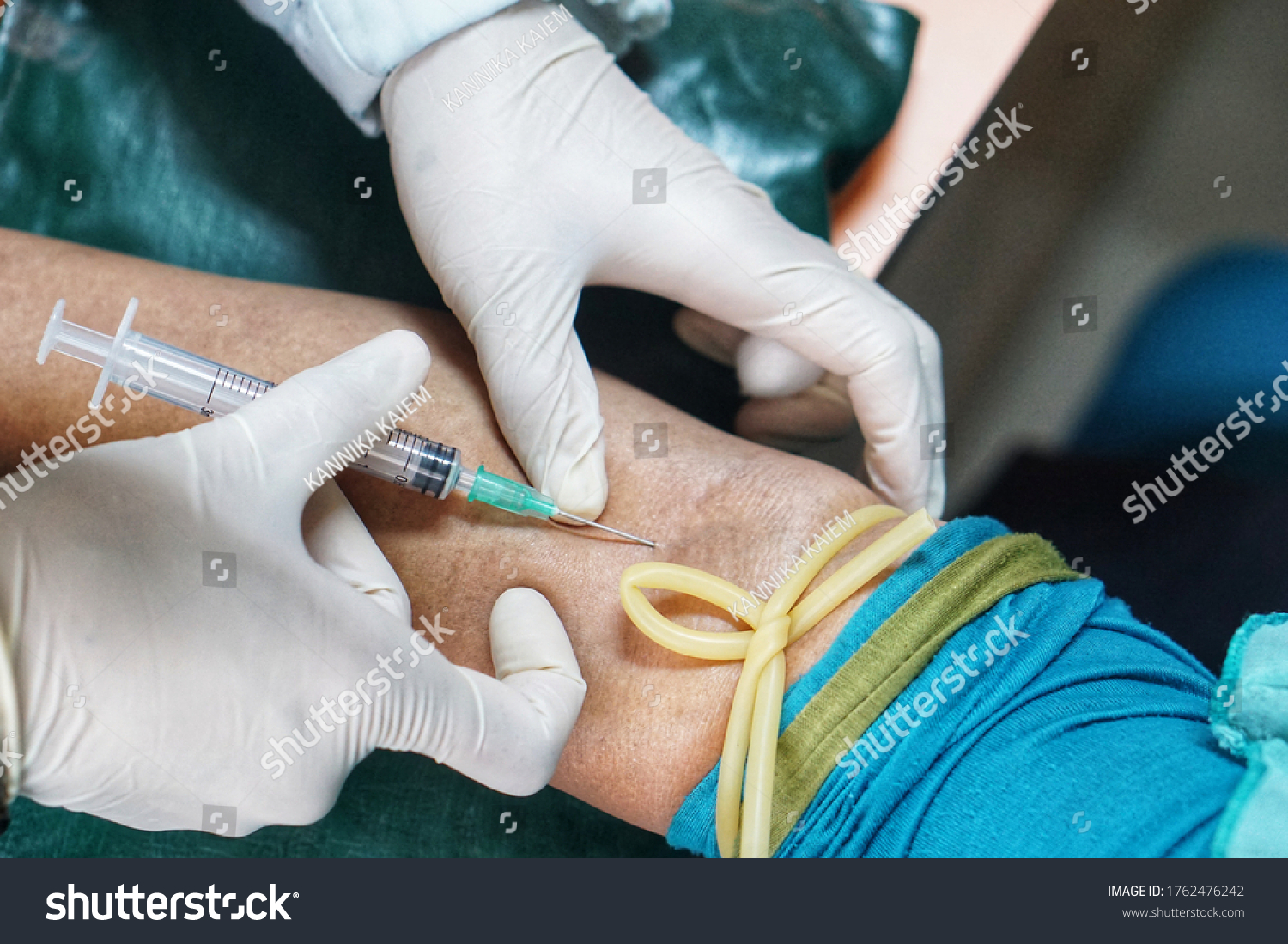 Draw Blood Large Vein Laboratory Examination Stock Photo 1762476242 ...