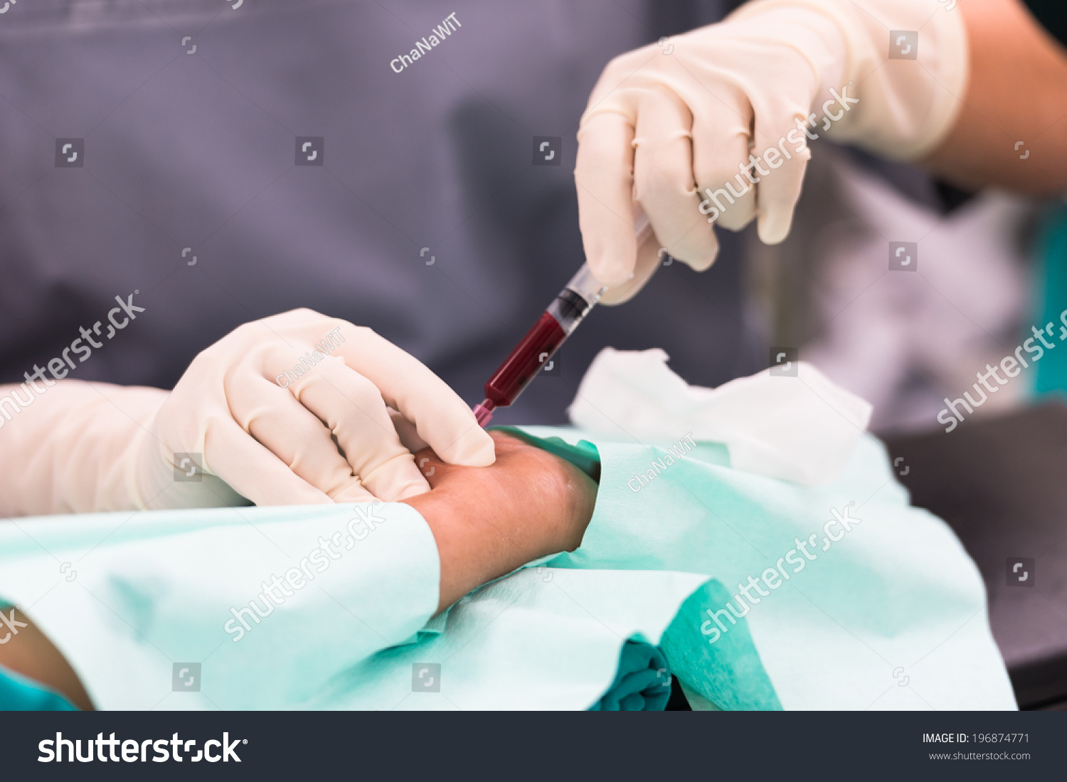 Drawing Blood Arterial Line Foto Stok 196874771 Shutterstock