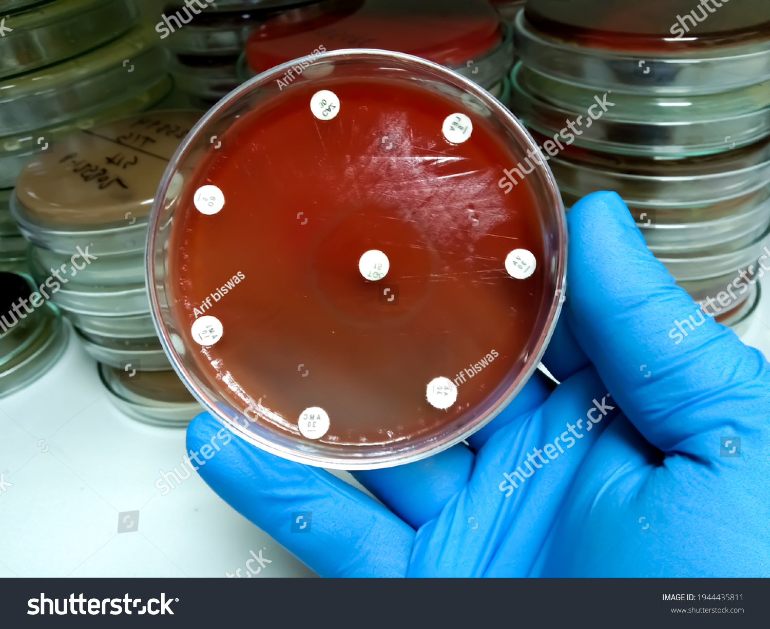 Drug Sensitivity Testing Blood Agar Media Stock Photo 1944435811 ...