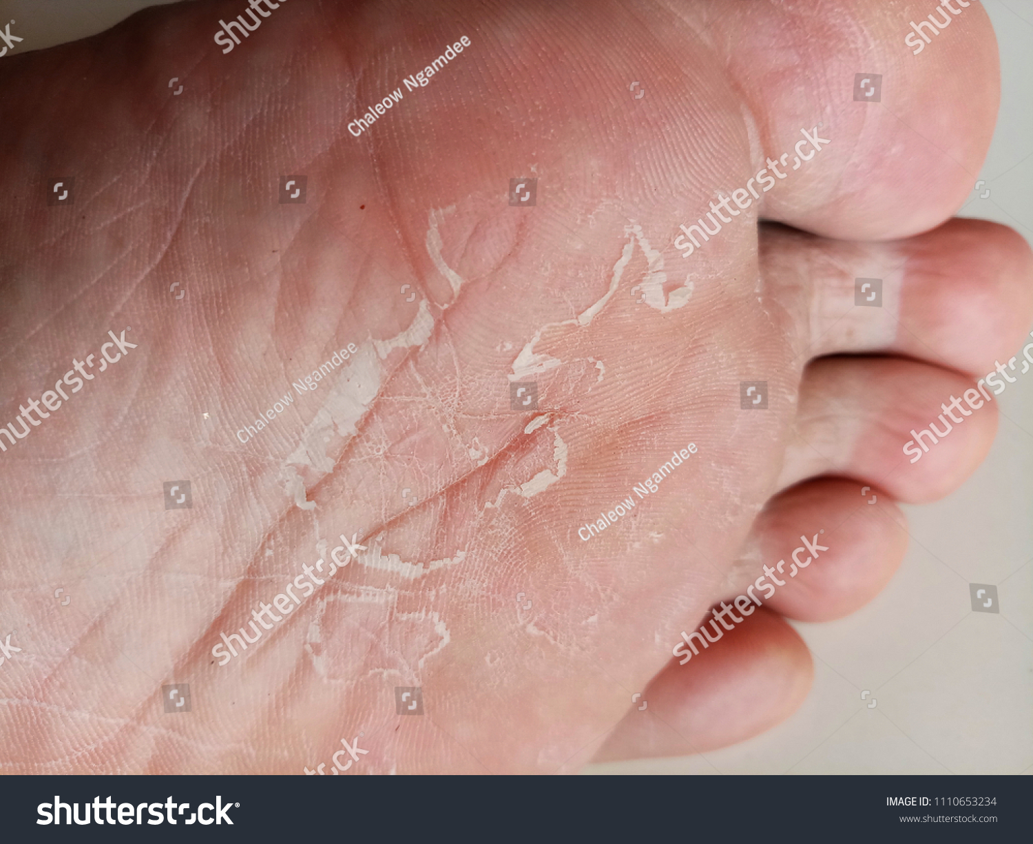 dry under feet