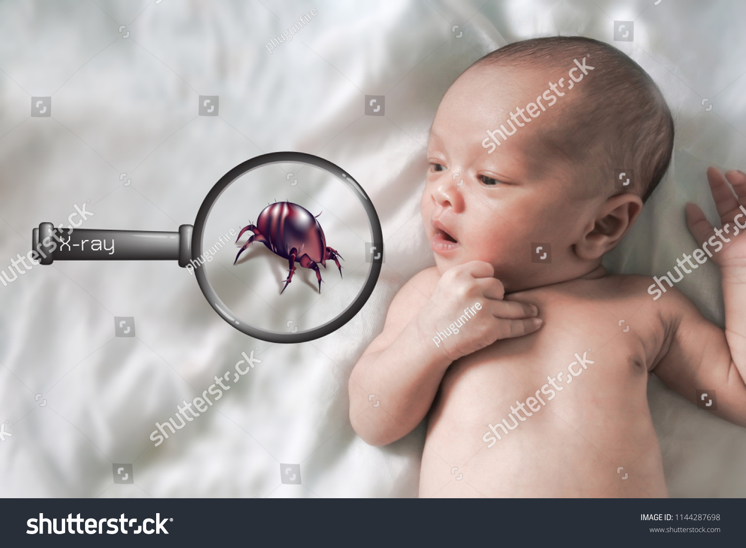 Dust Mites Babies Dangerous Dust Mite Stock Photo Edit Now 1144287698