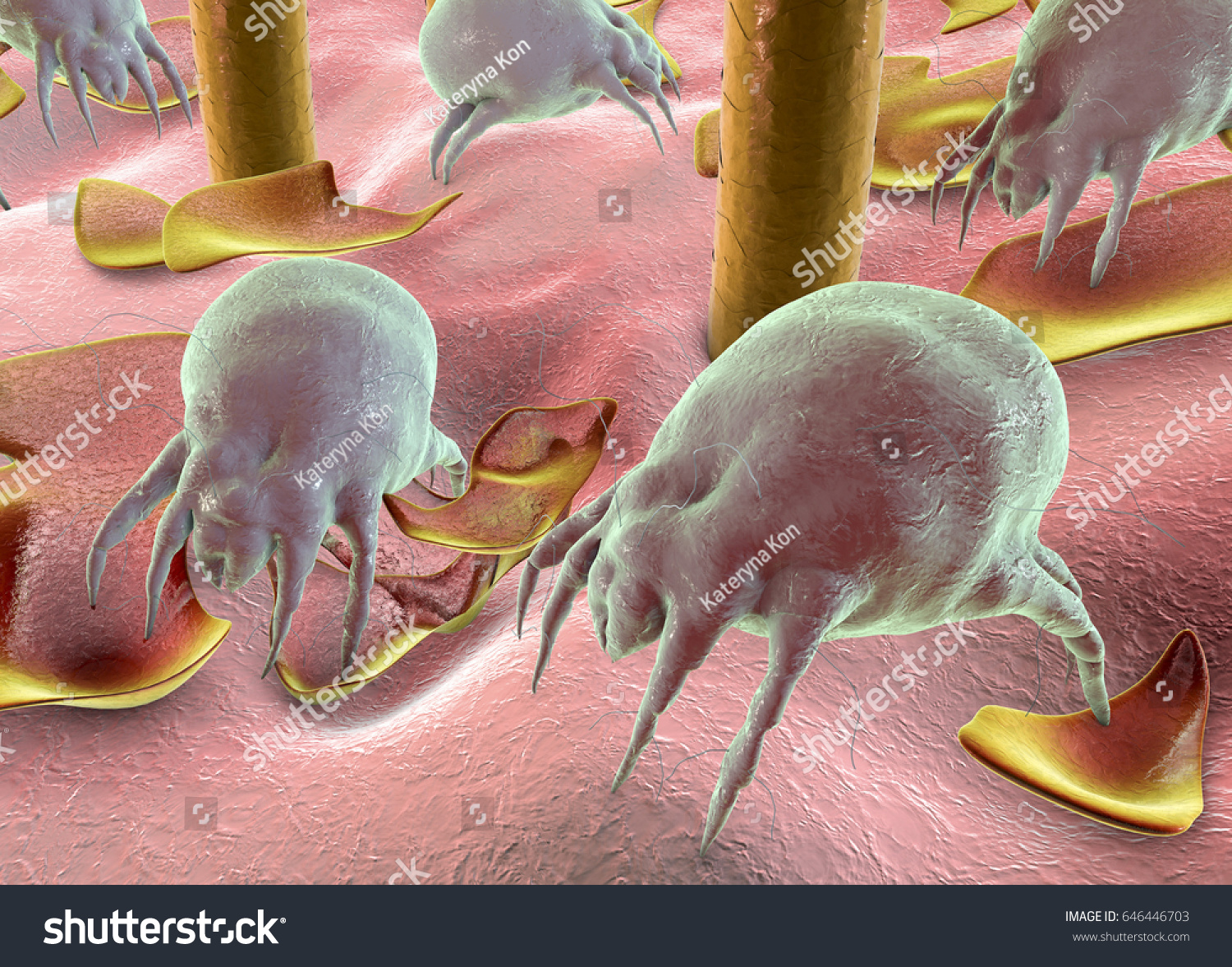 Dust Mite Dermatophagoides Which Lives In Dust And ...