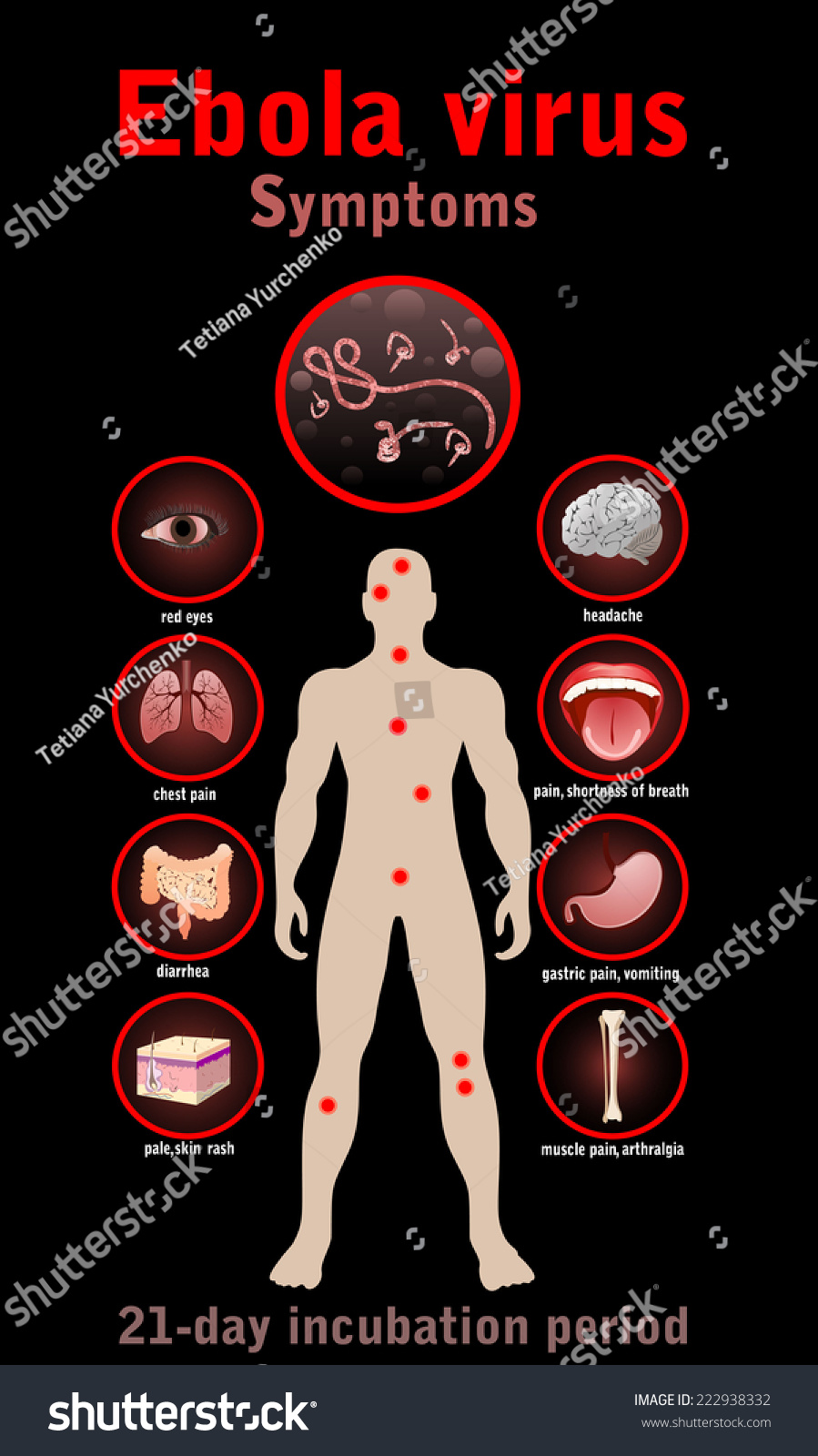 Ebola Virus Disease. Symptoms. Stock Photo 222938332 ...