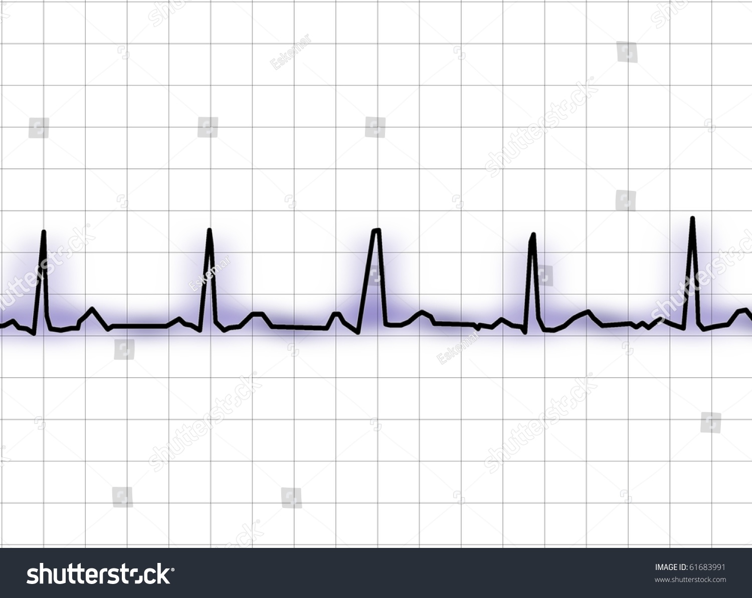 Ecg Electrocardiogram Stock Photo 61683991 : Shutterstock