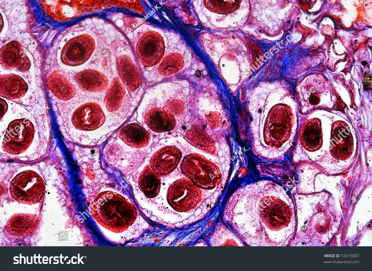 Echinococcus Granulosus Hydatid Sand