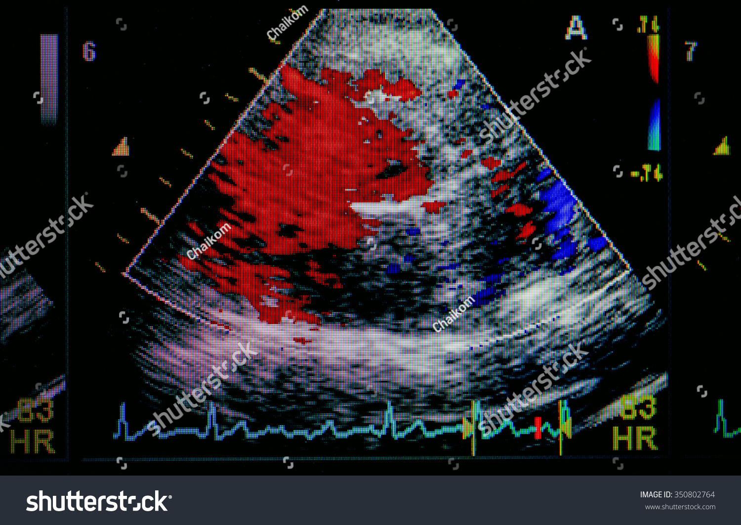 Echocardiography Ultrasound Machine Stock Photo 350802764 | Shutterstock