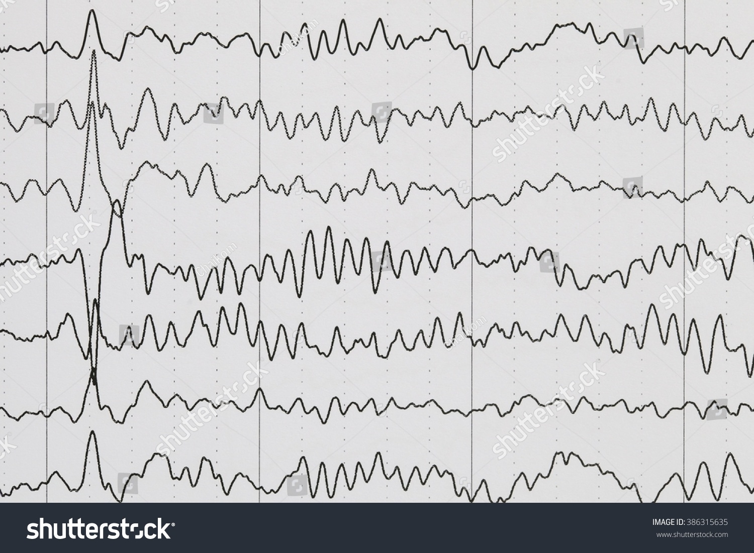 Eeg Wave Background Stock Photo 386315635 | Shutterstock