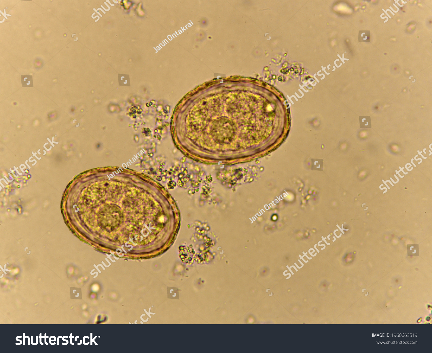 Oeuf Dascaris Lumbricoides Ver Rond Dans Photo De Stock Modifiable 1960663519 3581