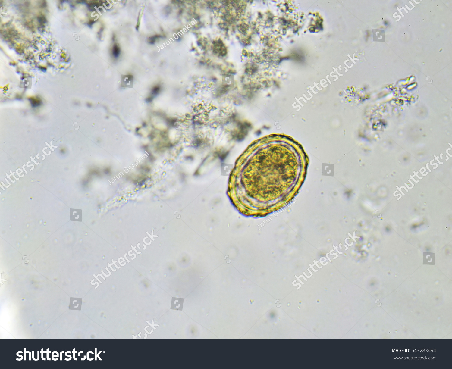 Egg Ascaris Lumbricoides Roundworm Stool Analyze Foto De Stock 643283494 Shutterstock 4451