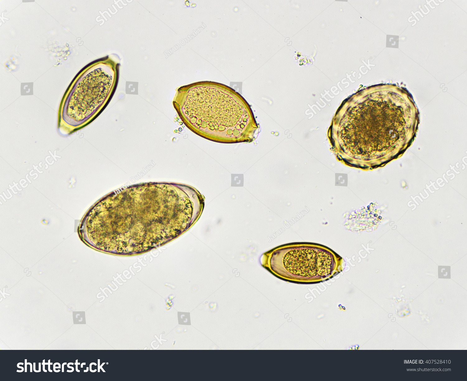 Egg Of Helminth In Stool, Analyze By Microscope Stock Photo 407528410 ...