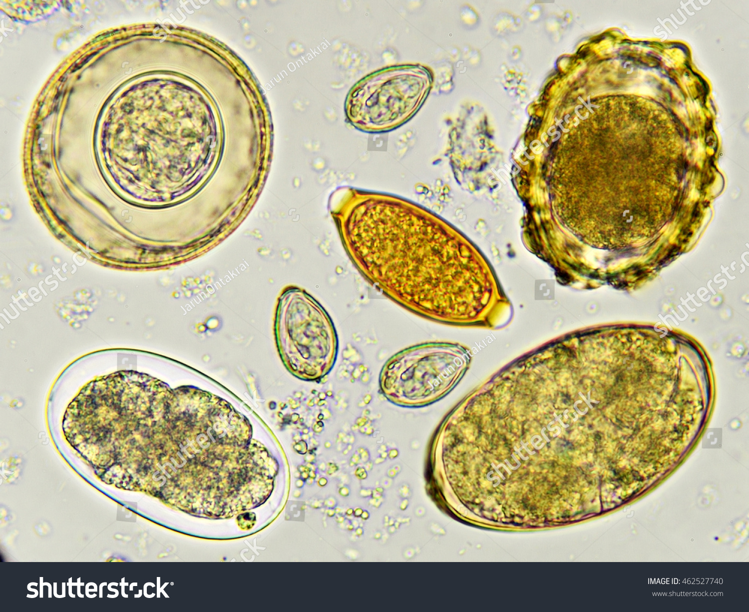 Egg Of Helminth In Stool, Analyze By Microscope Stock Photo 462527740 ...