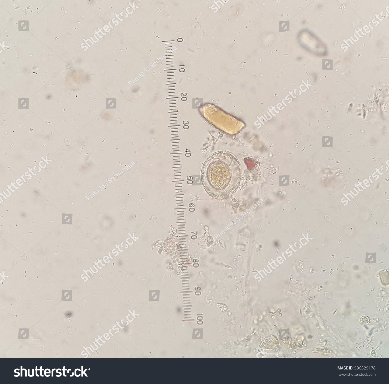 Worm In Stool - Stools Pinworm Eggs In Poop
