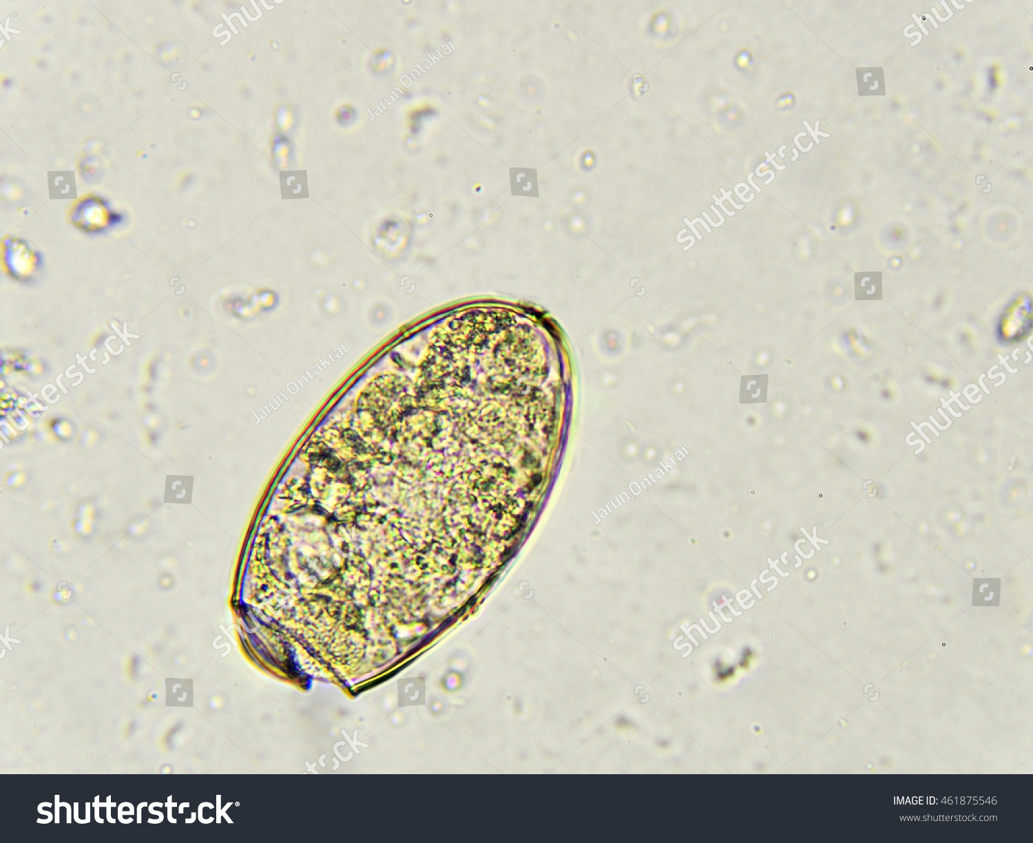 Paragonimus Westermani Under Microscope