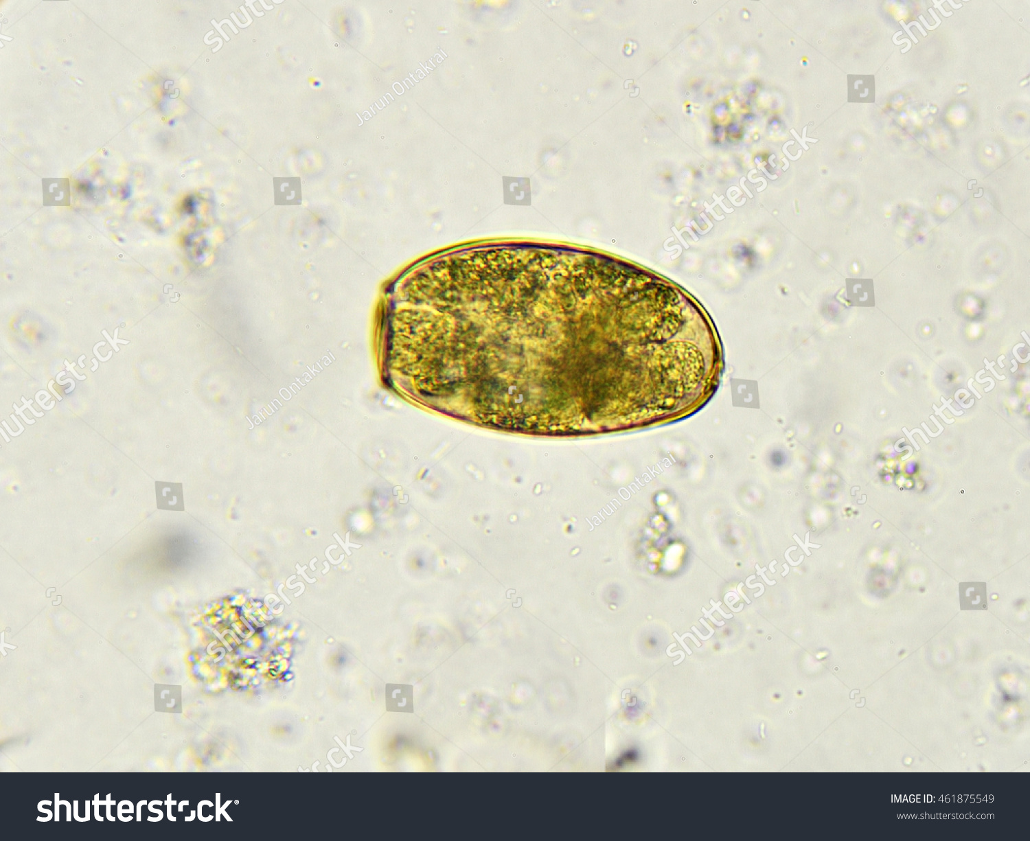 Egg Of Paragonimus Spp. (Lung Fluke) In Stool, Analyze By Microscope ...