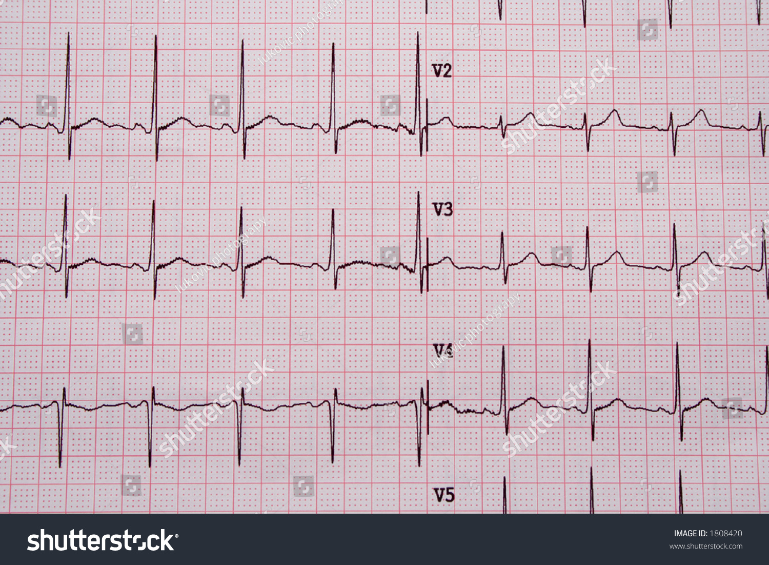 Ekg Graph Stock Photo 1808420 : Shutterstock