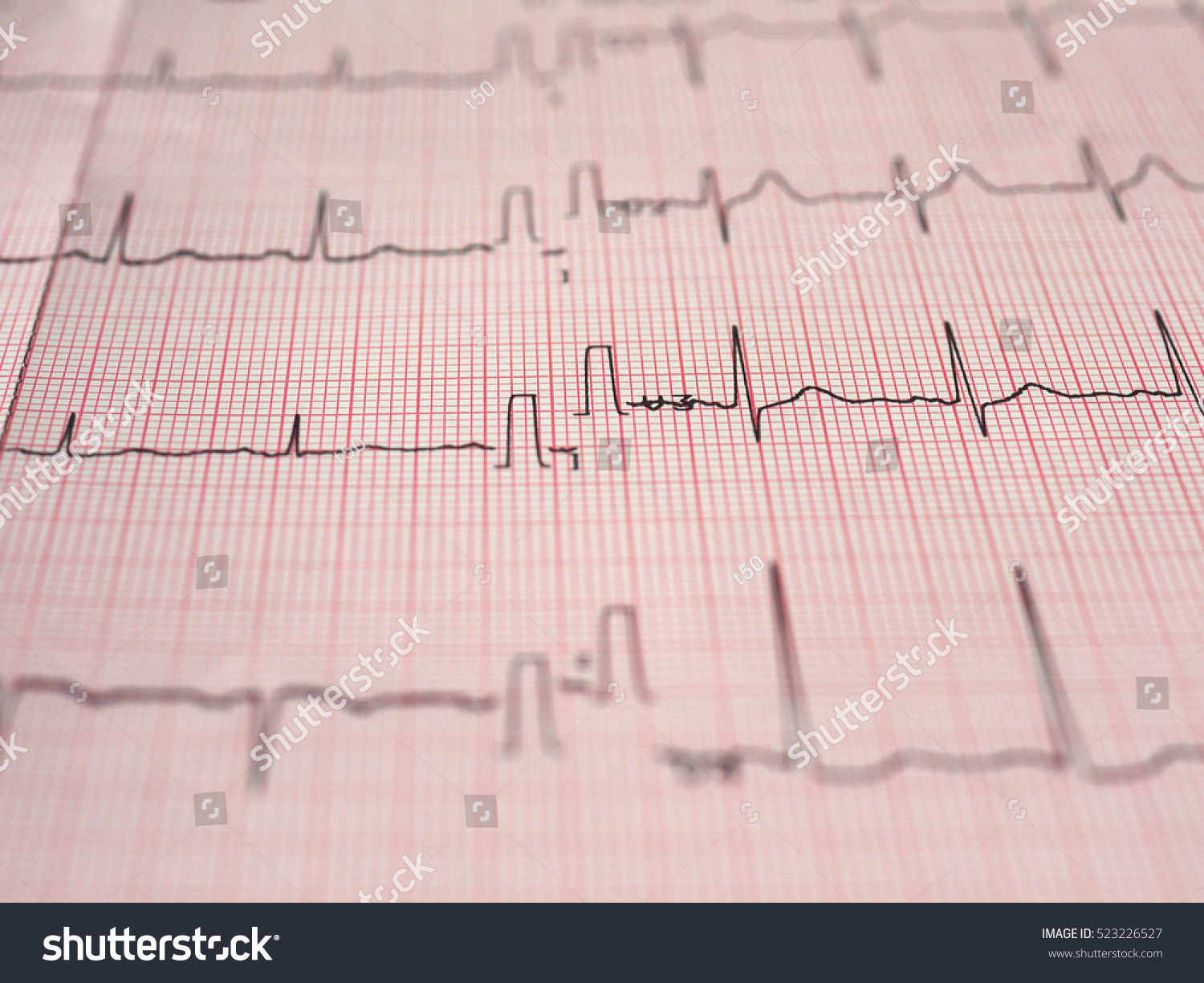 Electrocardiography Aka Ekg Elektrokardiogramm Measure Heartbeat Foto ...