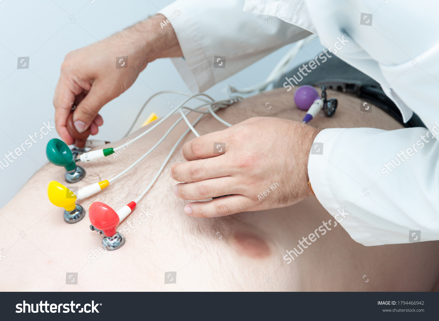 Electrocardiography