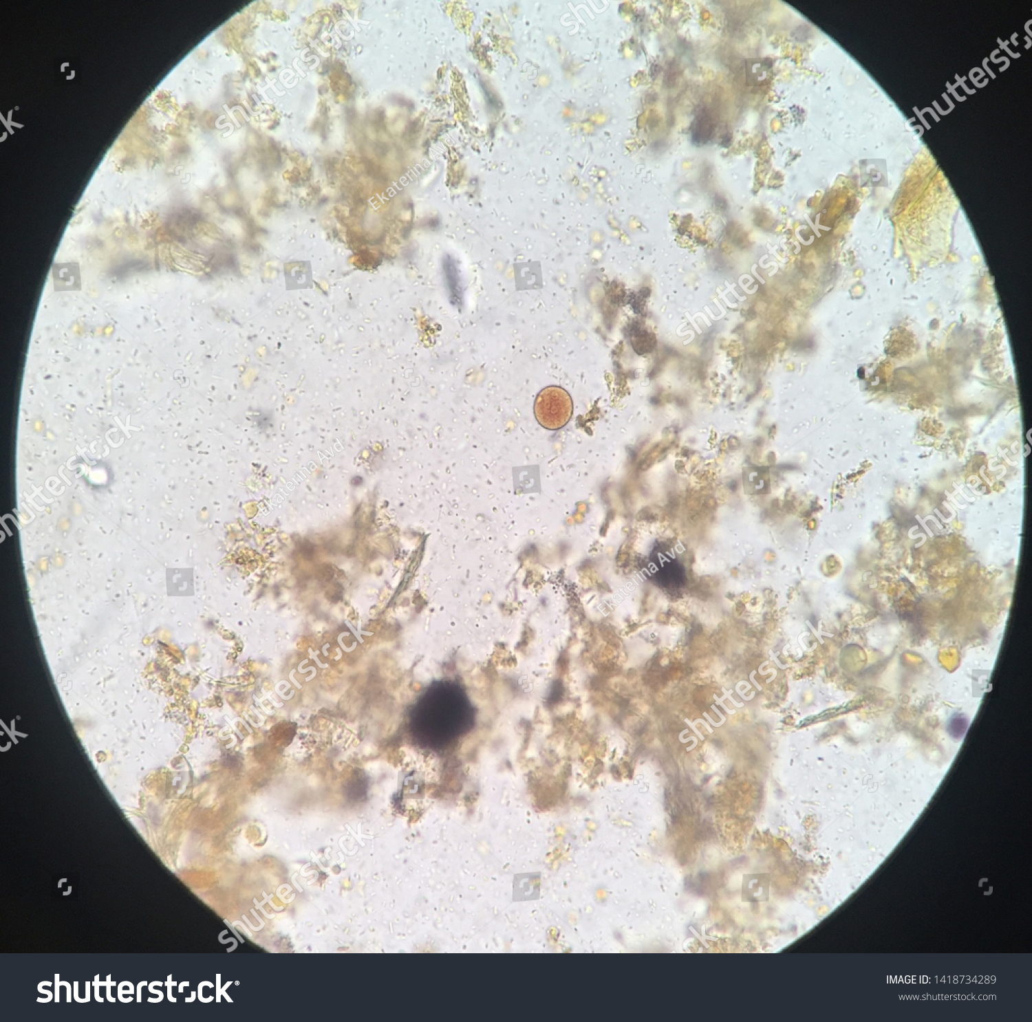 entamoeba coli