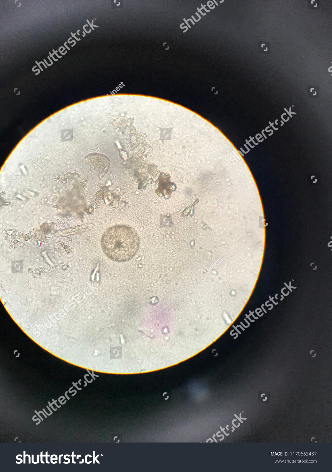 Entamoeba Histolytica Light Microscope Shutterstock Sexiz Pix 9096