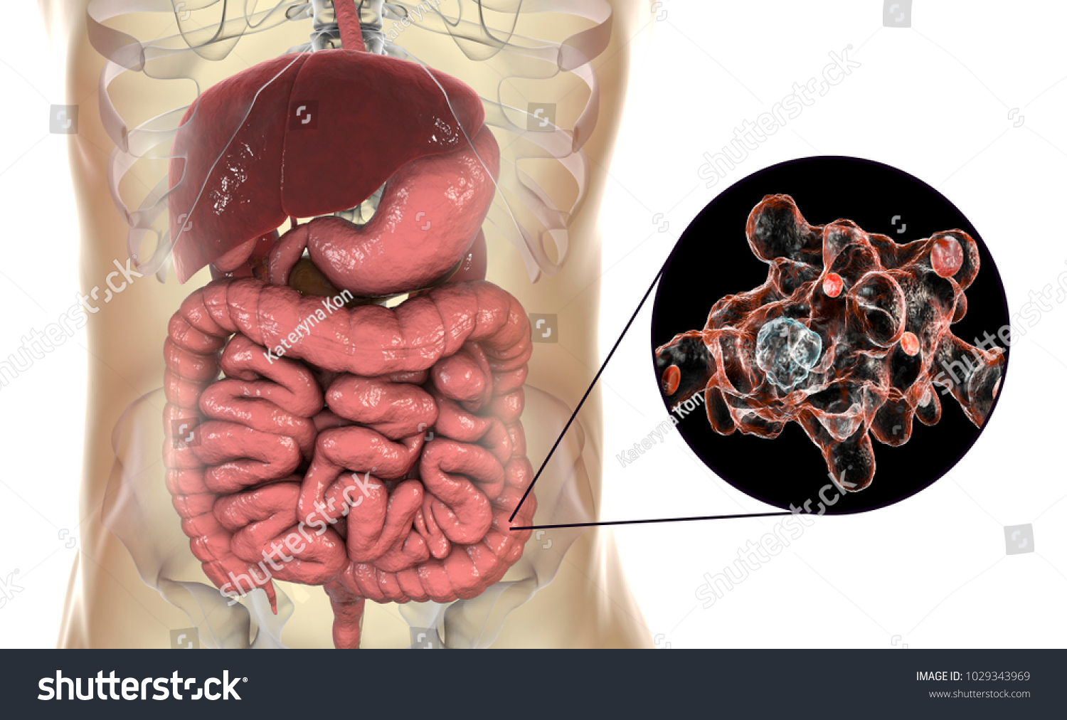 Entamoeba Histolytica Protozoan Infection Large Intestine Stock Illustration 1029343969 7227