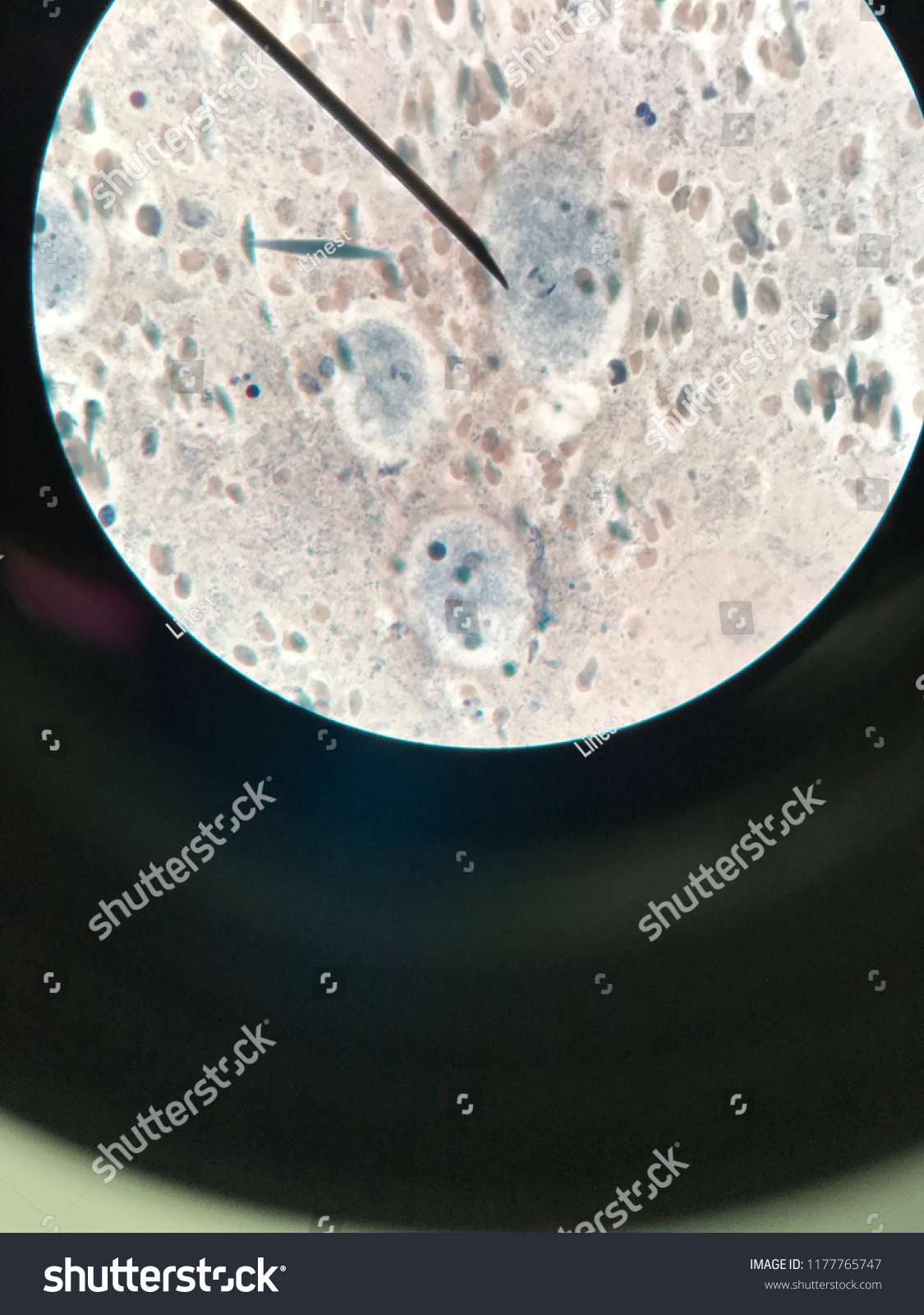 Entamoeba Histolytica Trophozoite Stage Light Microscope Foto Stock Editar Agora 1177765747 9242