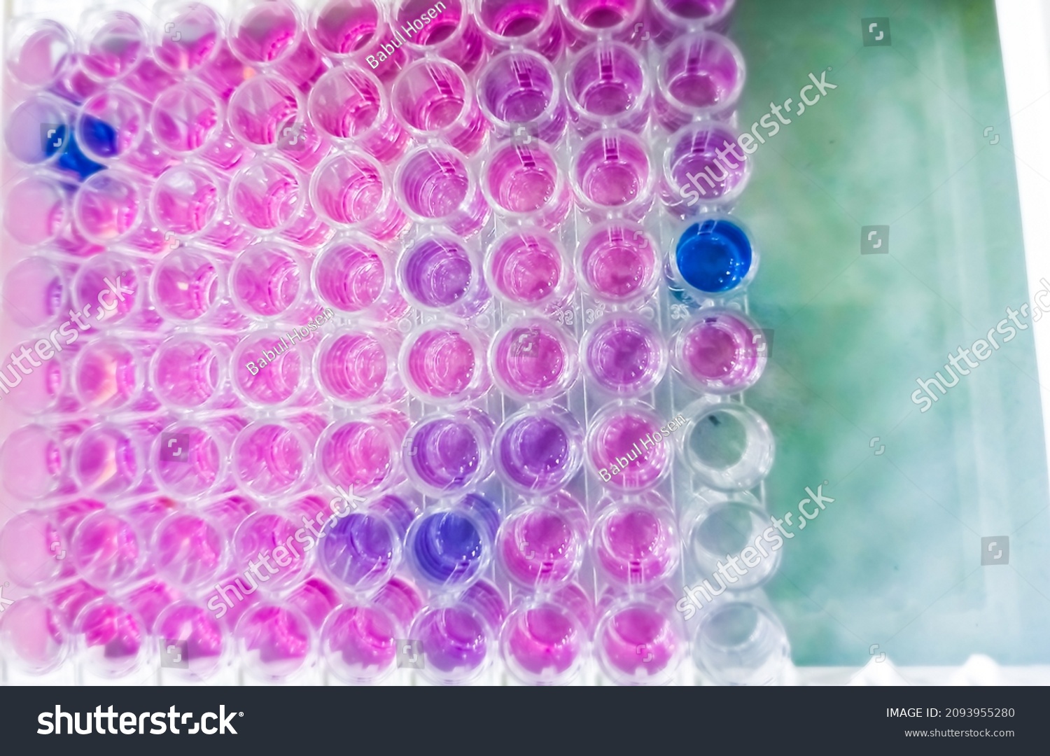 enzymelinked-immunosorbent-assay-elisa-plate-anti-2093955280