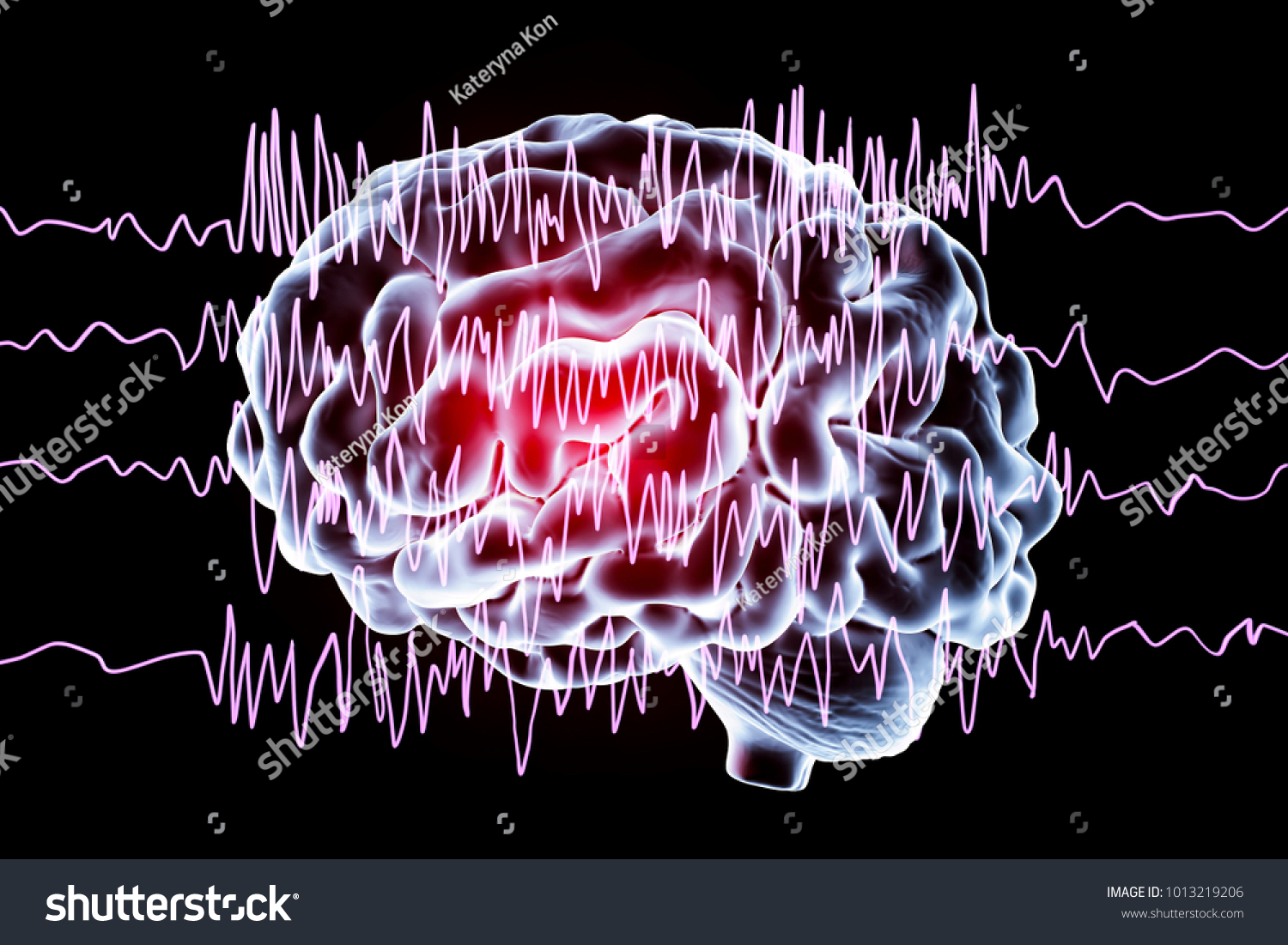 Epilepsy Awareness Concept Brain Encephalography Epilepsy Stock Illustration 1013219206 4971