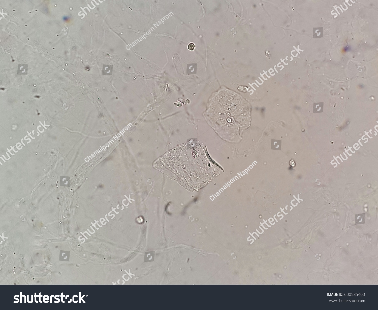 Стоковая фотография 600535400 Epithelial Cells Urine Under Microscope Urinalysis Shutterstock