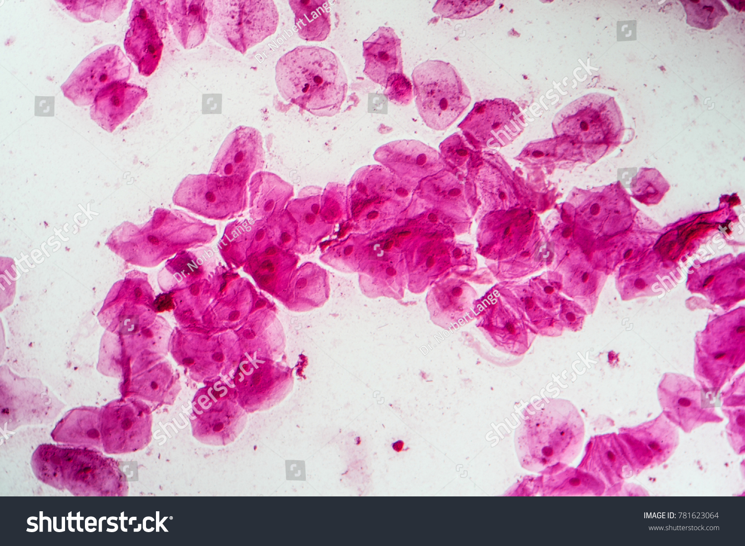 Epithelial Cells Bacteria Oral Cavity Stock Photo (Edit Now) 781623064