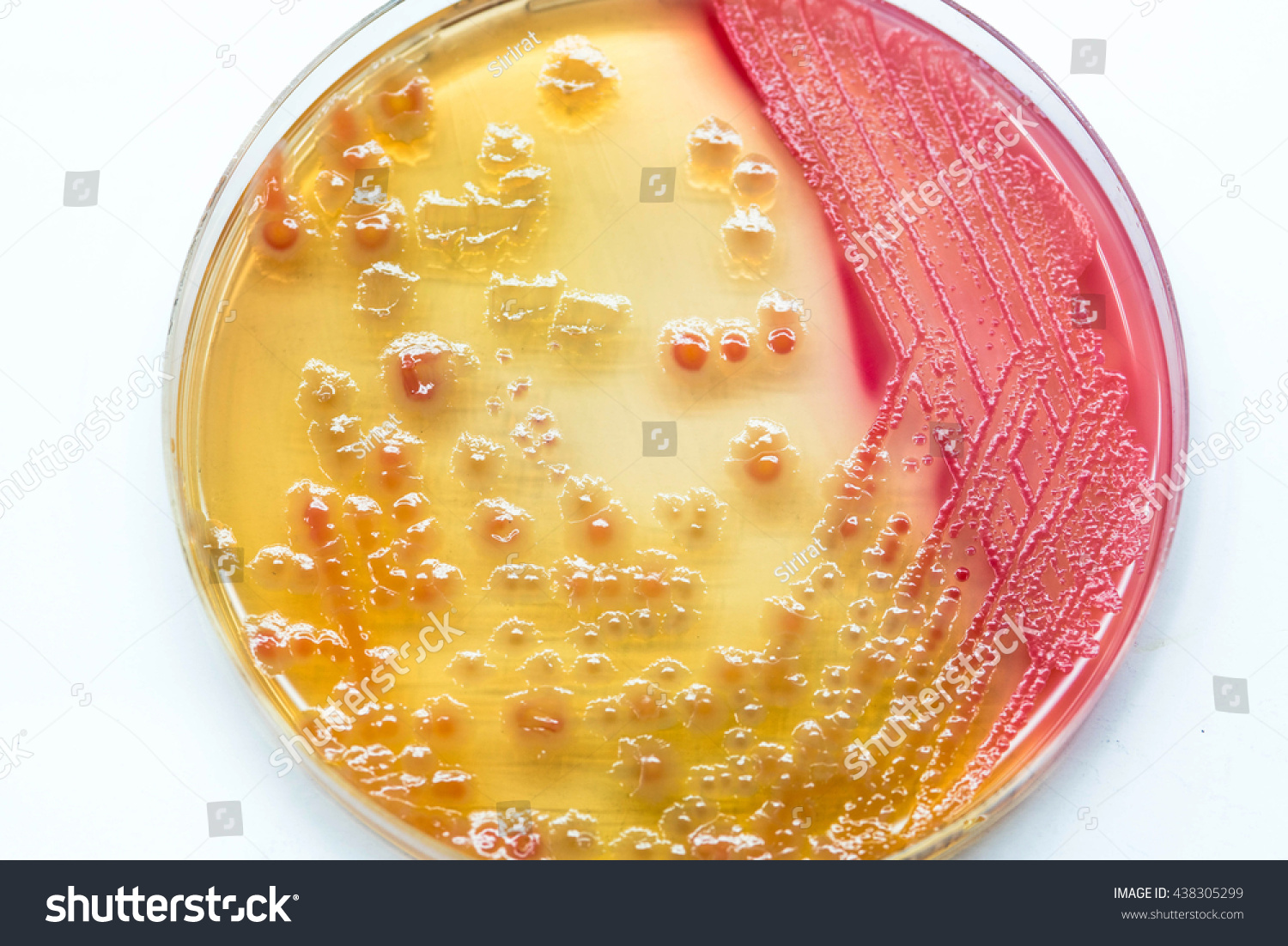 Escherichia Coli Bacterial Culture Growth On Stock Photo 438305299 ...