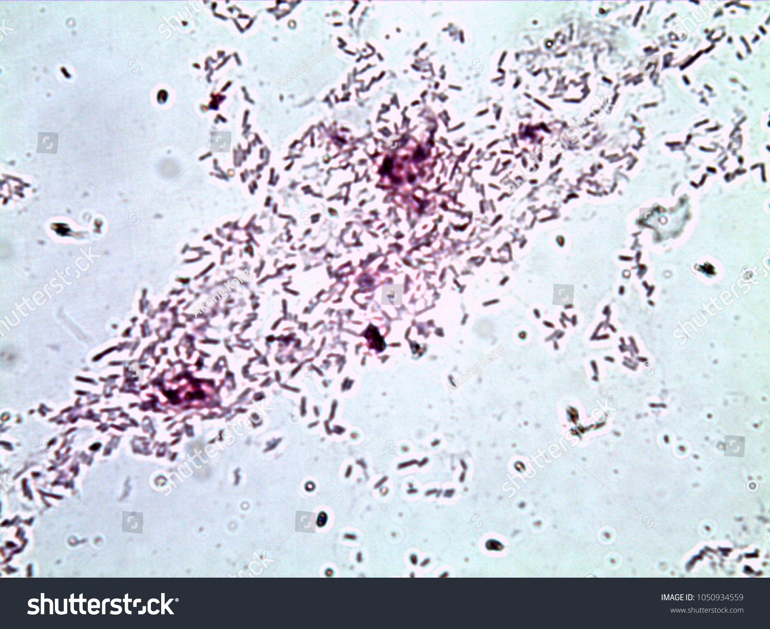 Escherichia Coli Gram Stain Compound Microscope Stock Photo Edit Now