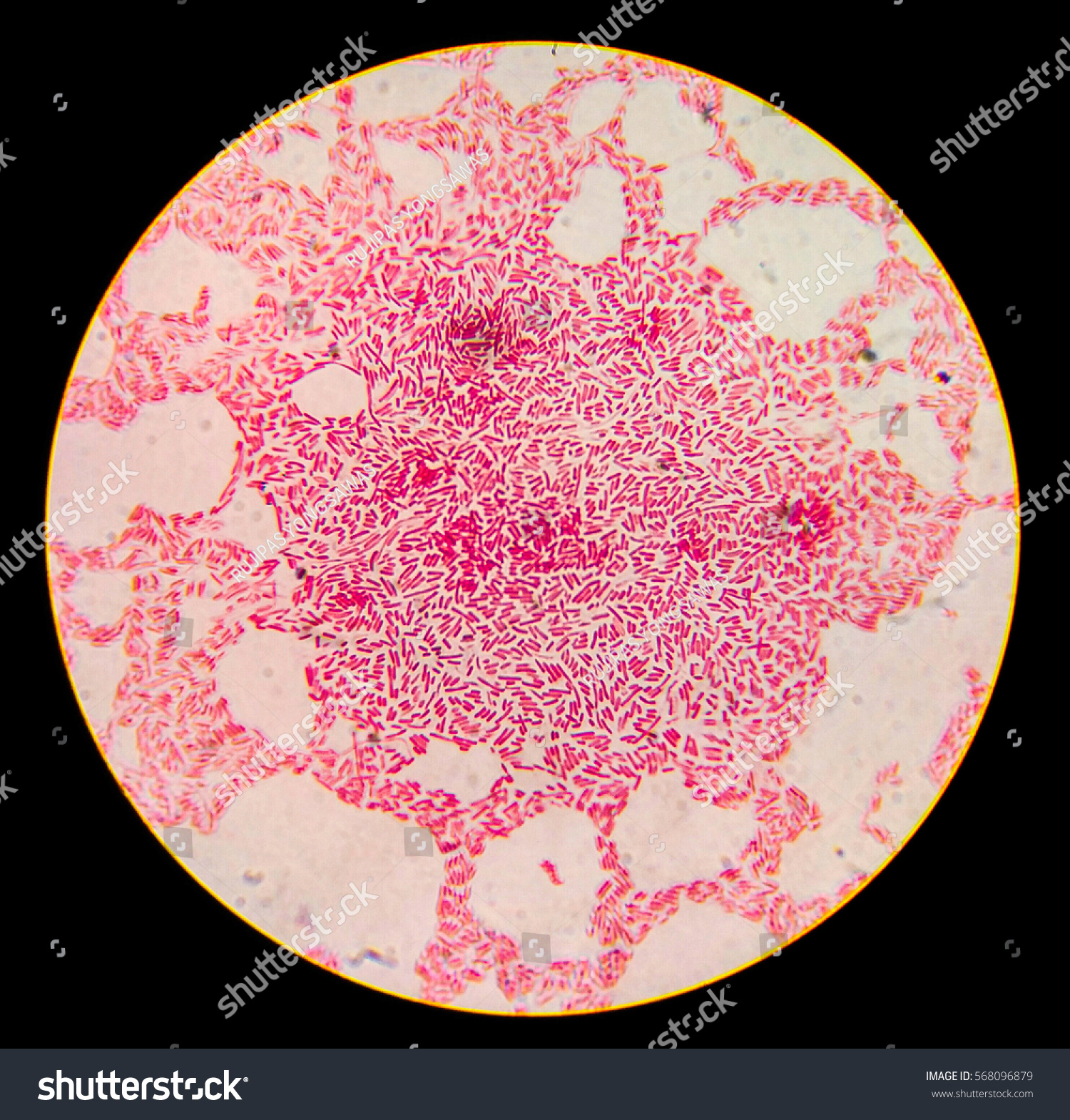 Escherichia Coli Gram Staining Compound Microscope Stock Photo Edit Now