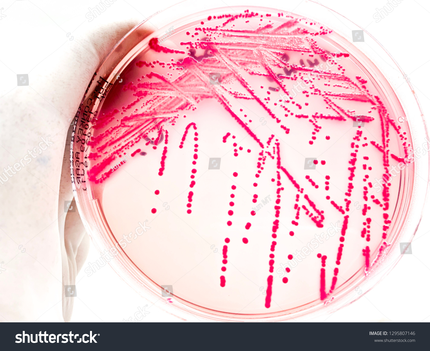 Escherichia Coli Growth On Macconkey Agar Stock Photo 1295807146 ...