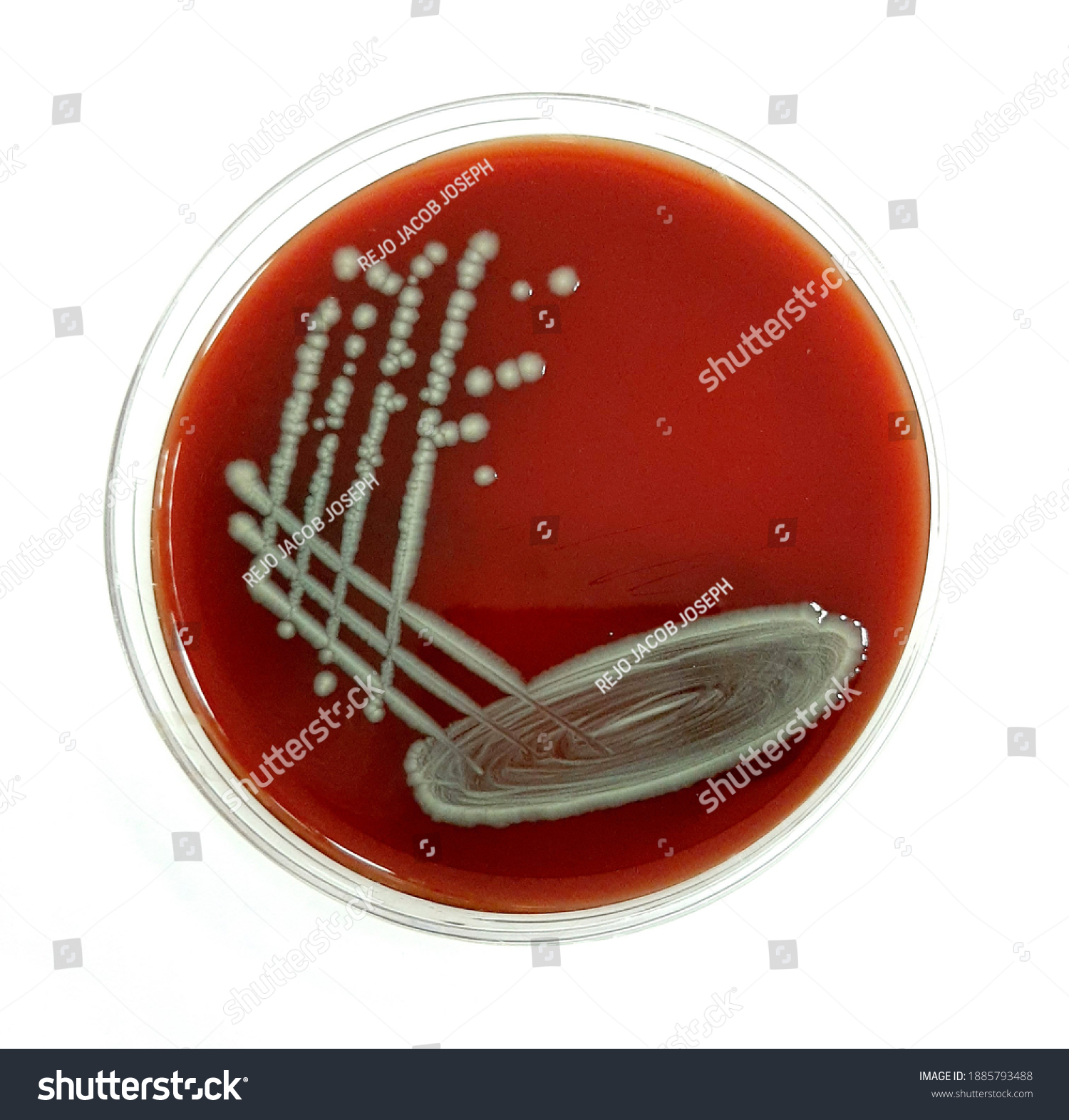 Escherichia Coli On Blood Agar Stock Photo 1885793488 | Shutterstock