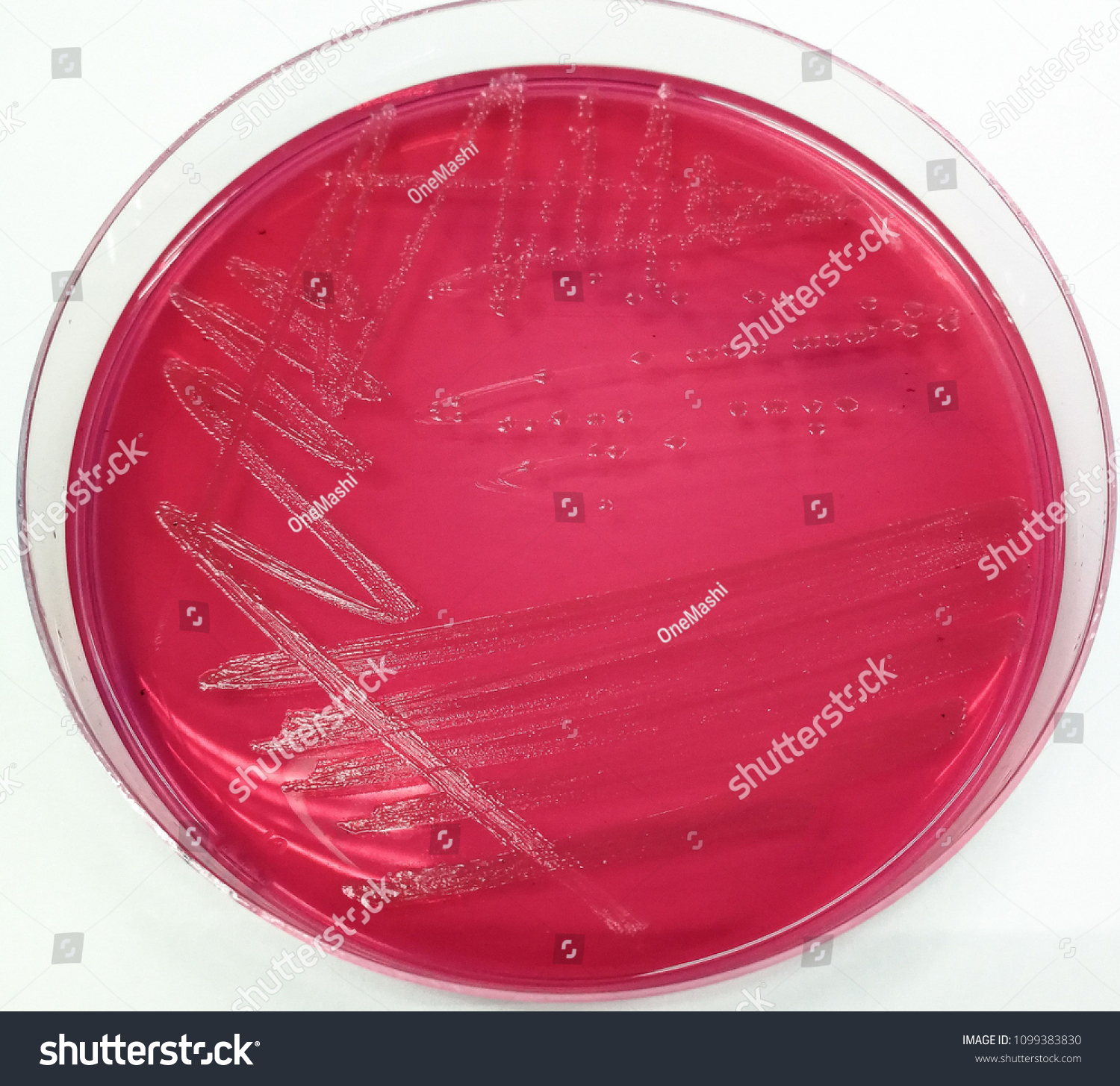 Escherichia Macconkey Agar Stock Photo (Edit Now) 1099383830