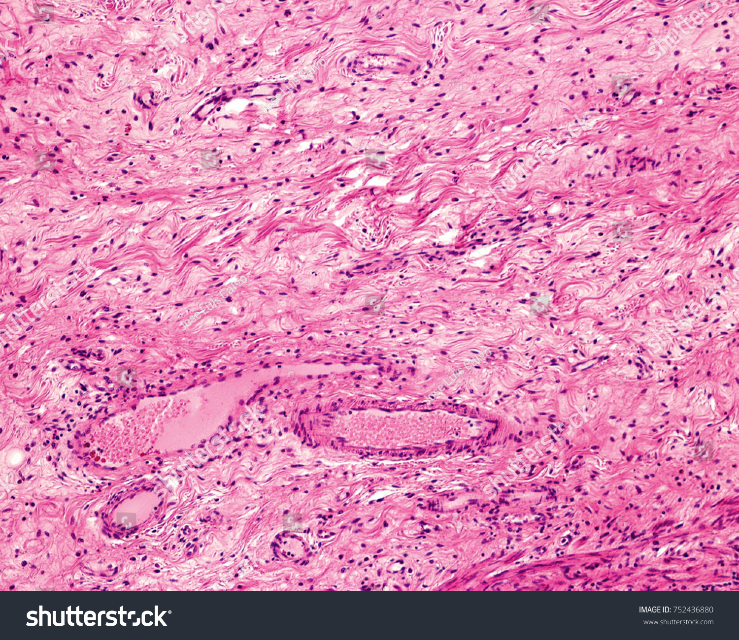 Example Typical Loose Connective Tissue Belonging Stock Photo