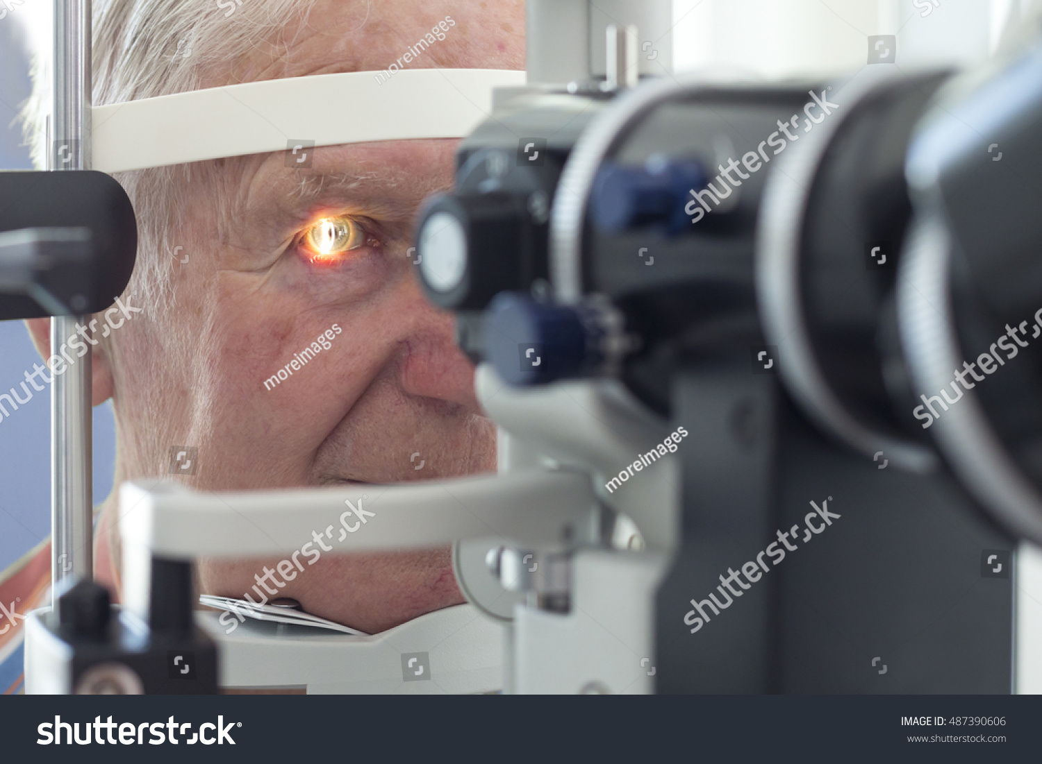 Eye Examination Slit Lamp Stock Photo 487390606 Shutterstock   Stock Photo Eye Examination At The Slit Lamp 487390606 