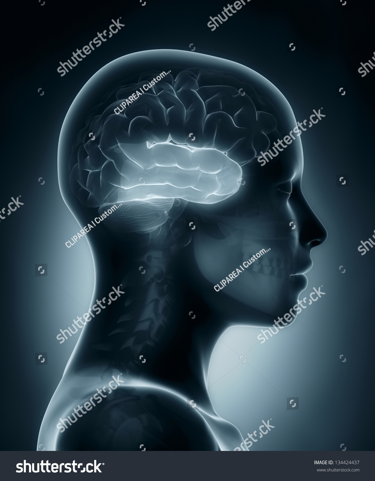 Female Temporal Lobe Medical Xray Scan Stock Illustration 134424437 Shutterstock 0329