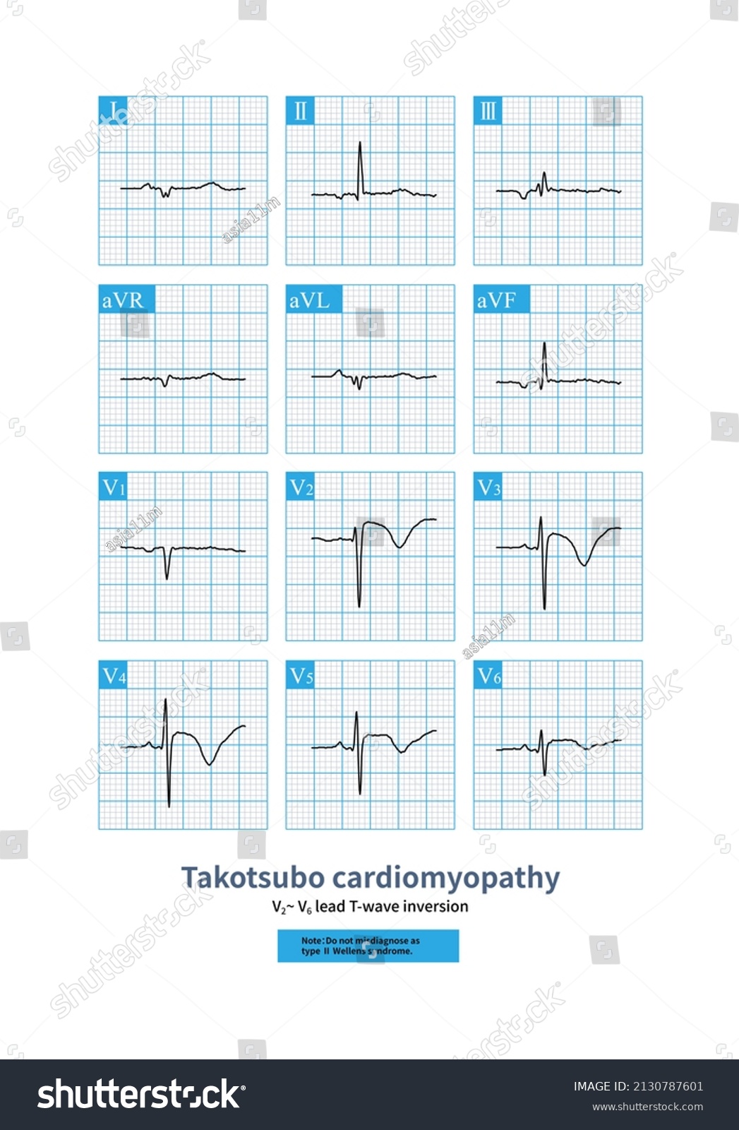 Female 66 Years Old Admitted Hospital Stock Illustration 2130787601 ...