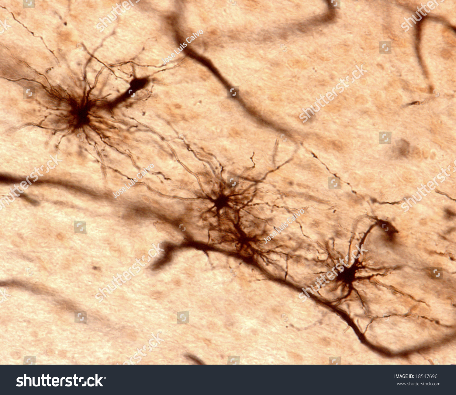 Fibrous Astrocytes Brain Tissue Showing Many Stock Photo 185476961 ...