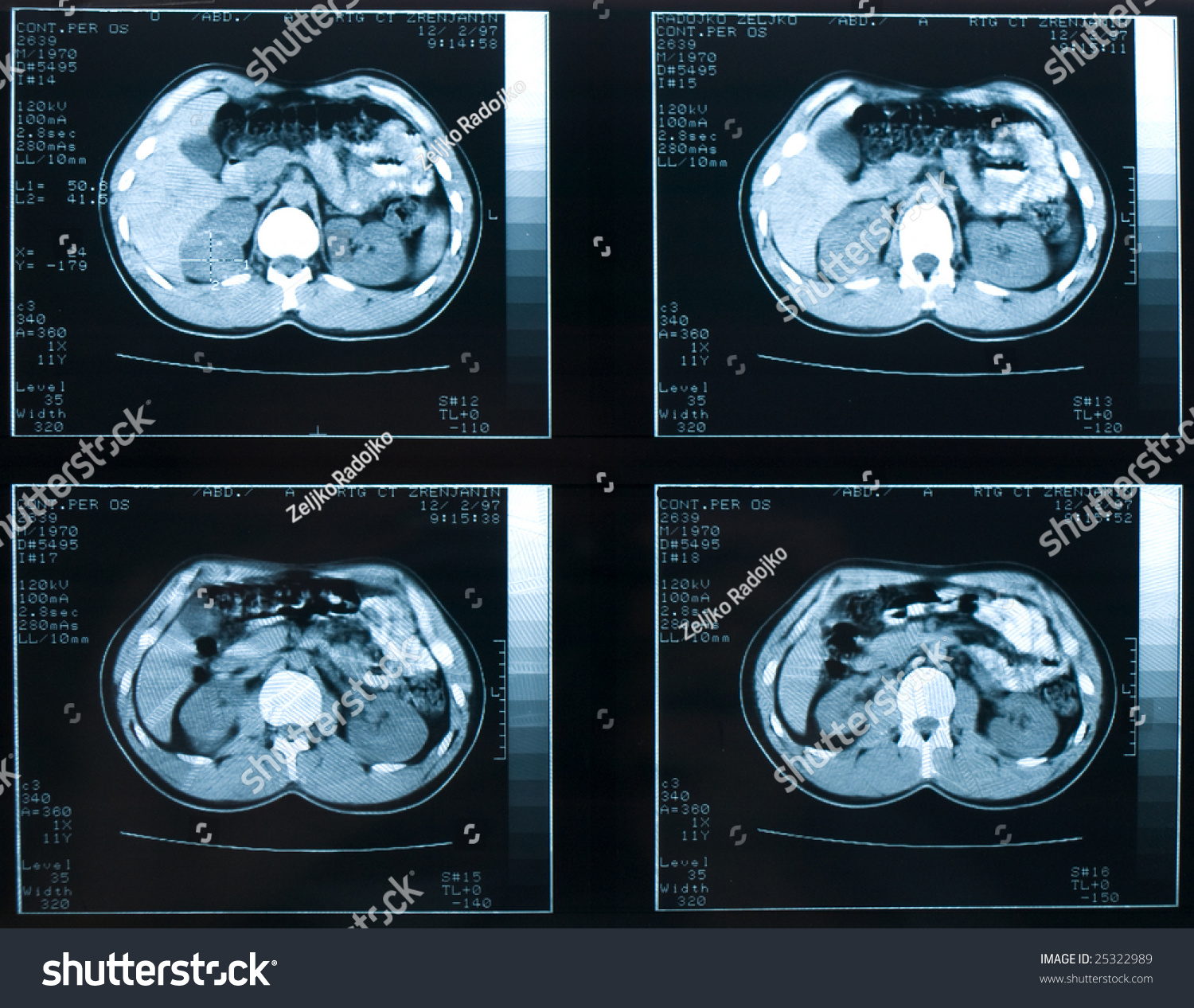 Film Of Mri Scans Stock Photo 25322989 : Shutterstock