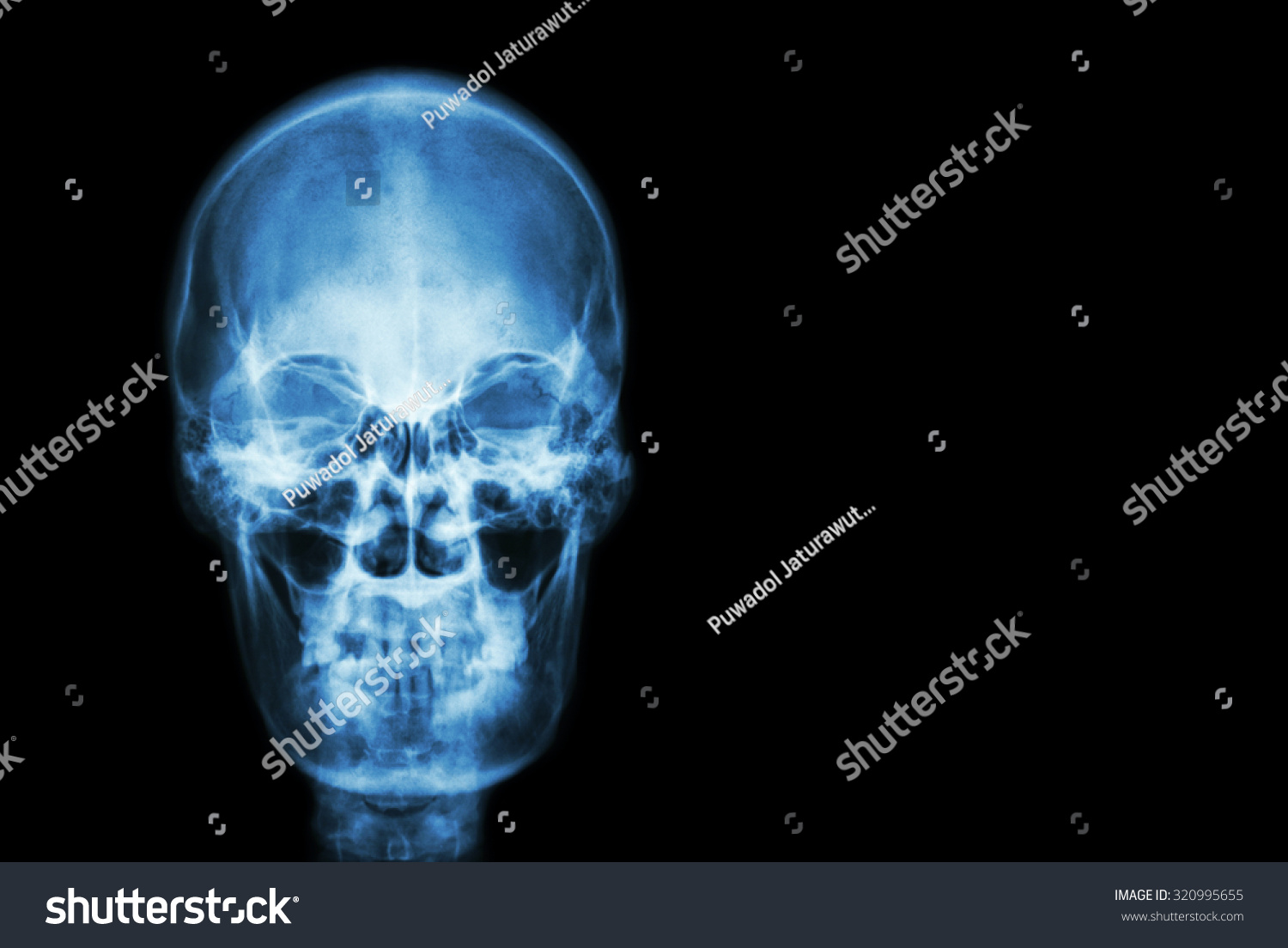 Film Xray Skull Human Blank Area Stock Photo 320995655 Shutterstock