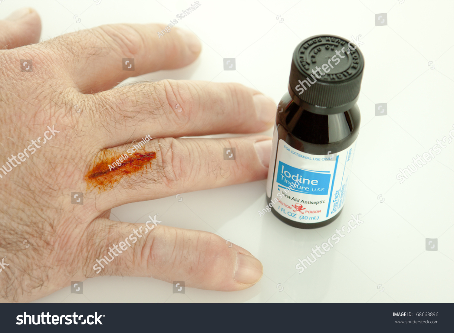 iodine treatment