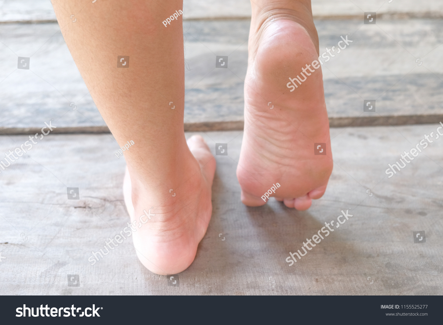 flat feet walking
