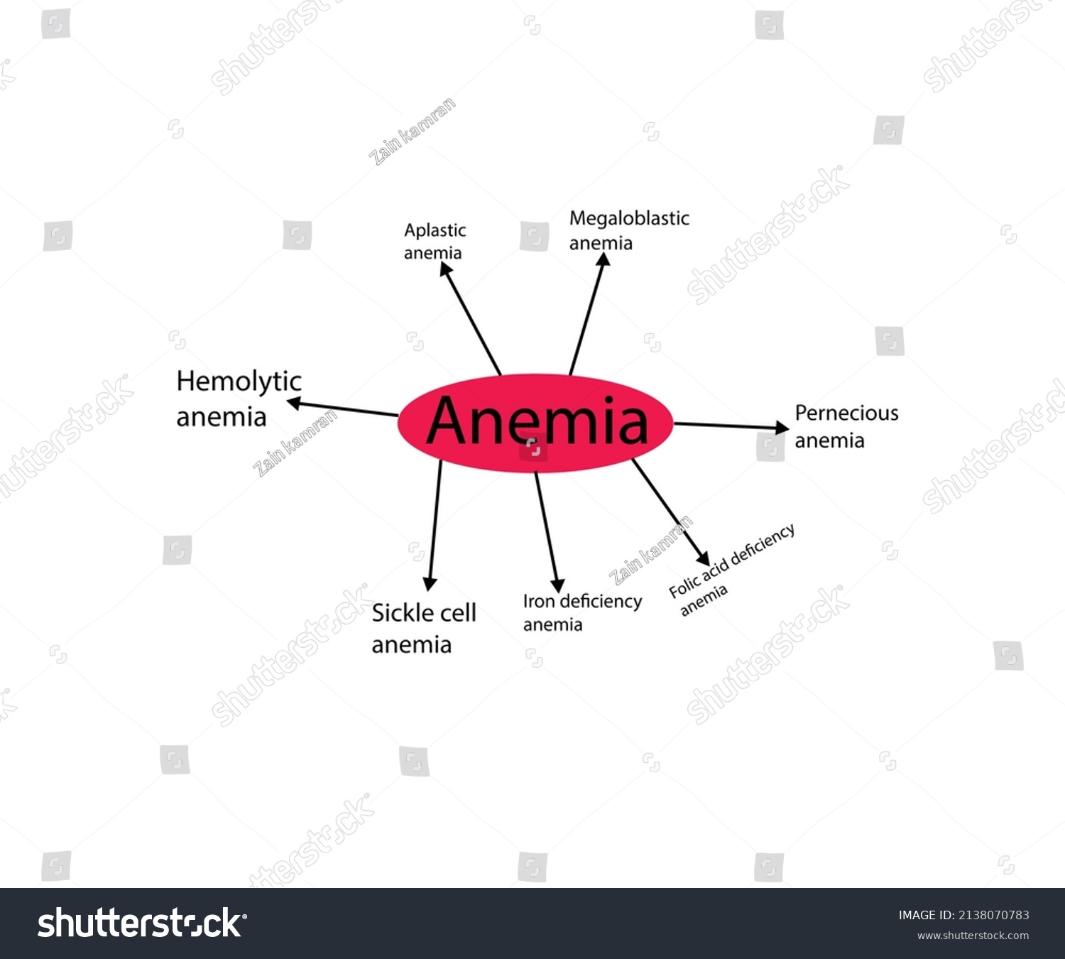 Flow Chart Types Anemia Diagram Which Stock Illustration Shutterstock