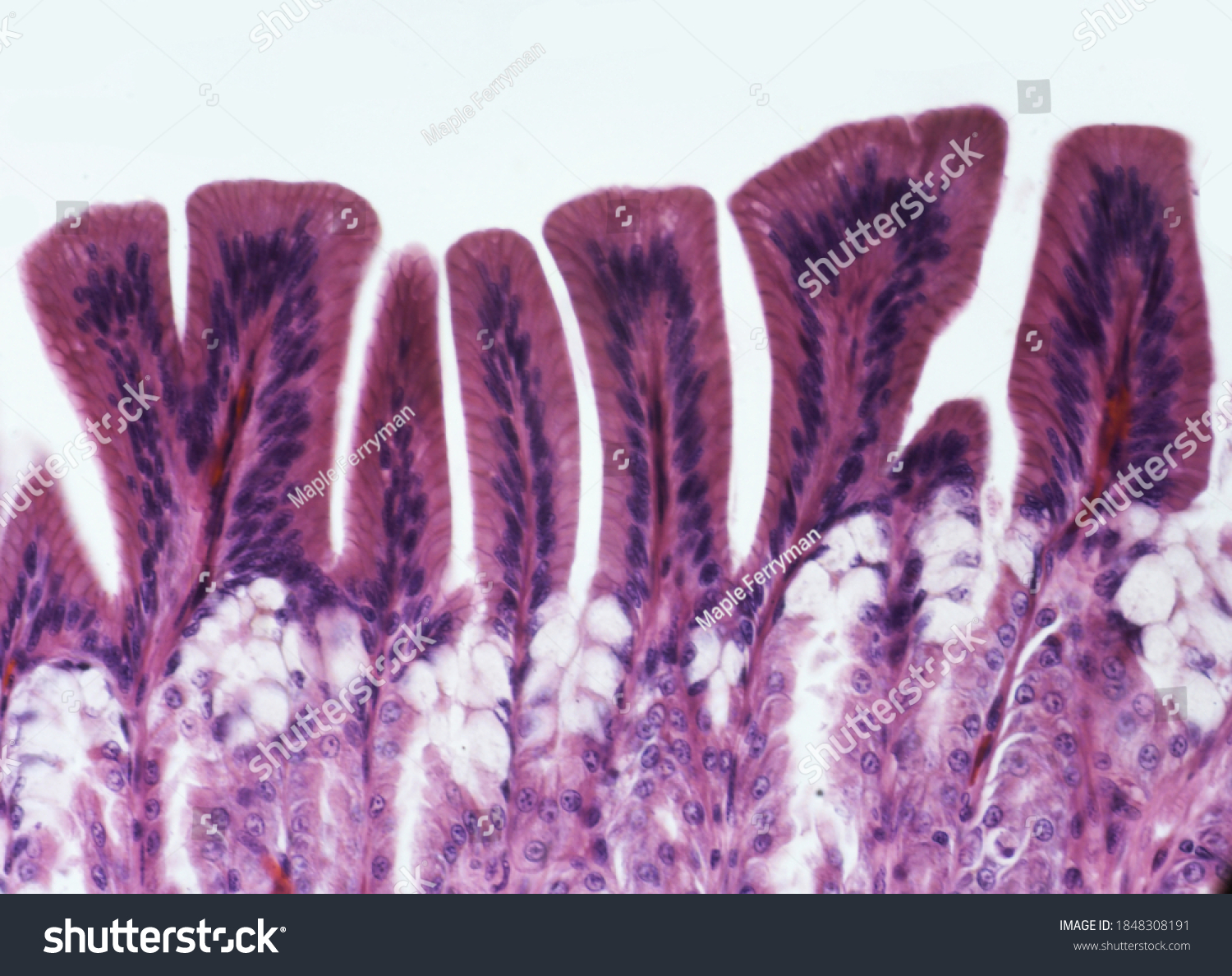 5,369 Intestine microscope Images, Stock Photos & Vectors | Shutterstock